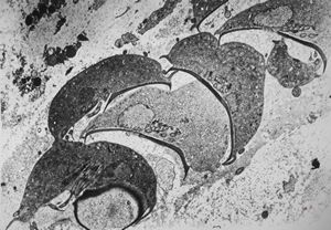Giardia (Lamblia) intestinalis Giardia (Lamblia) intestinalis